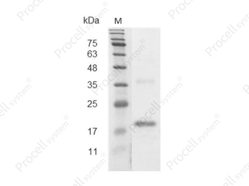 VEGF165/VPF, Mouse, Recombinant