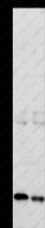 GNRHR Polyclonal Antibody - 1