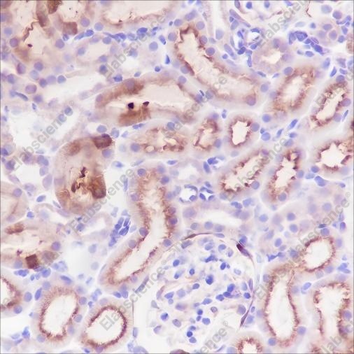 Recombinant Alpha B Crystallin Monoclonal Antibody - 7