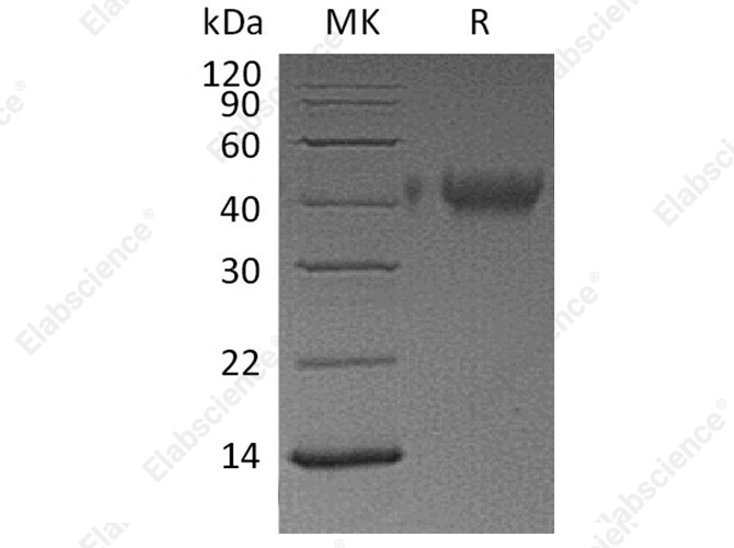 Recombinant Human TIM-3/HAVCR2 Protein (His Tag) - 1