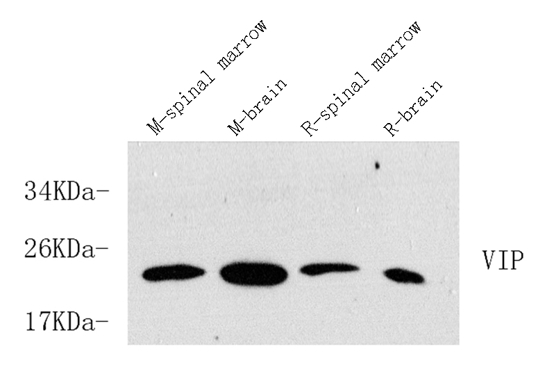 Western Blot analysis of various samples using VIP Polyclonal Antibody at dilution of 1:600.