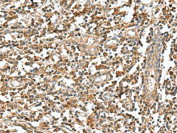 Immunohistochemistry of paraffin-embedded Human tonsil tissue  using RAB23 Polyclonal Antibody at dilution of 1:50(?200)