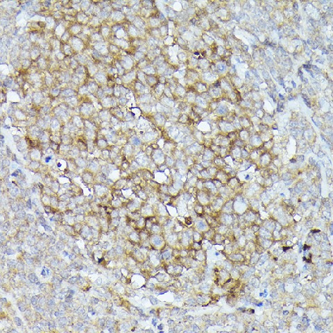 Immunohistochemistry of paraffin-embedded human tonsil using CD10/MME Polyclonal antibody at dilution of 1:50 (40x lens).Perform high pressure antigen retrieval with 10 mM citrate buffer pH 6.0 before commencing with IHC staining protocol.