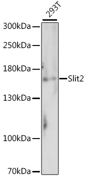 Western blot analysis of extracts of 293T cells using Slit2 Polyclonal Antibody