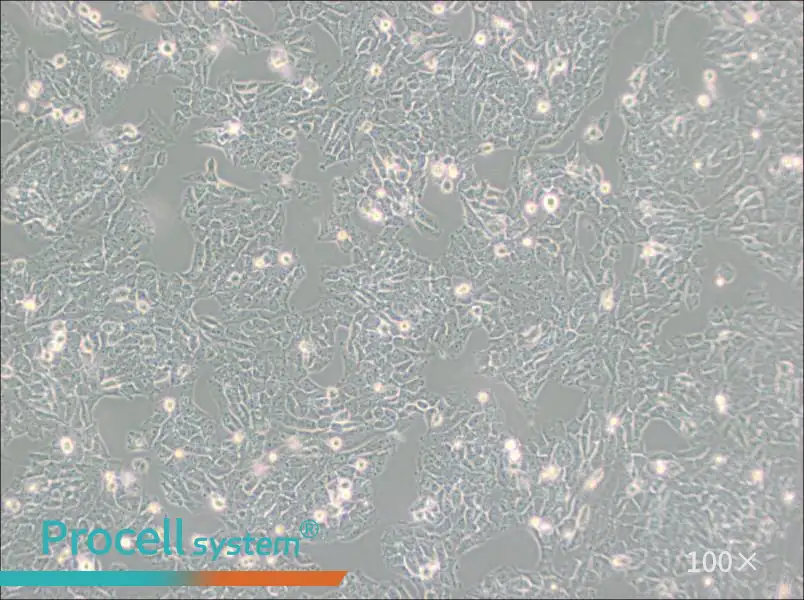 SK-N-AS Cell Complete Medium - 2