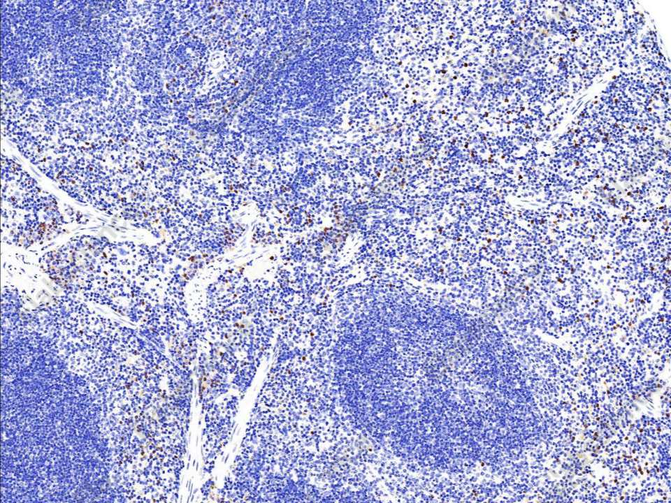 Recombinant S100A9 Monoclonal Antibody - 1