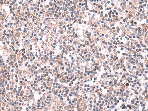 Immunohistochemistry of paraffin-embedded Human tonsil tissue  using GSPT2 Polyclonal Antibody at dilution of 1:50(?200)