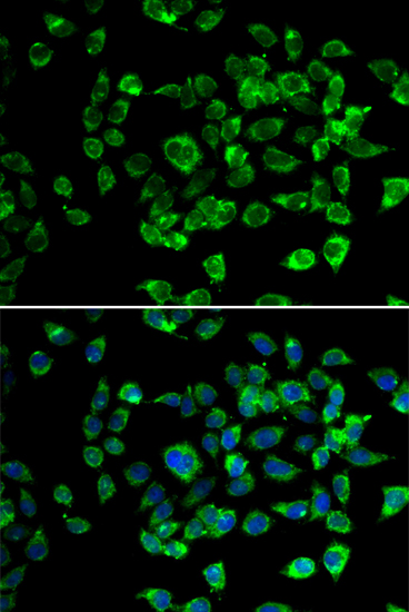 Immunofluorescence analysis of U2OS cells using PSMD13 Polyclonal Antibody Blue: DAPI for nuclear staining.