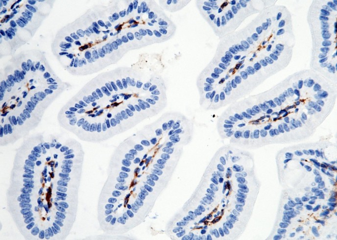 Recombinant CD16-2/FCGR4 Monoclonal Antibody - small - 4