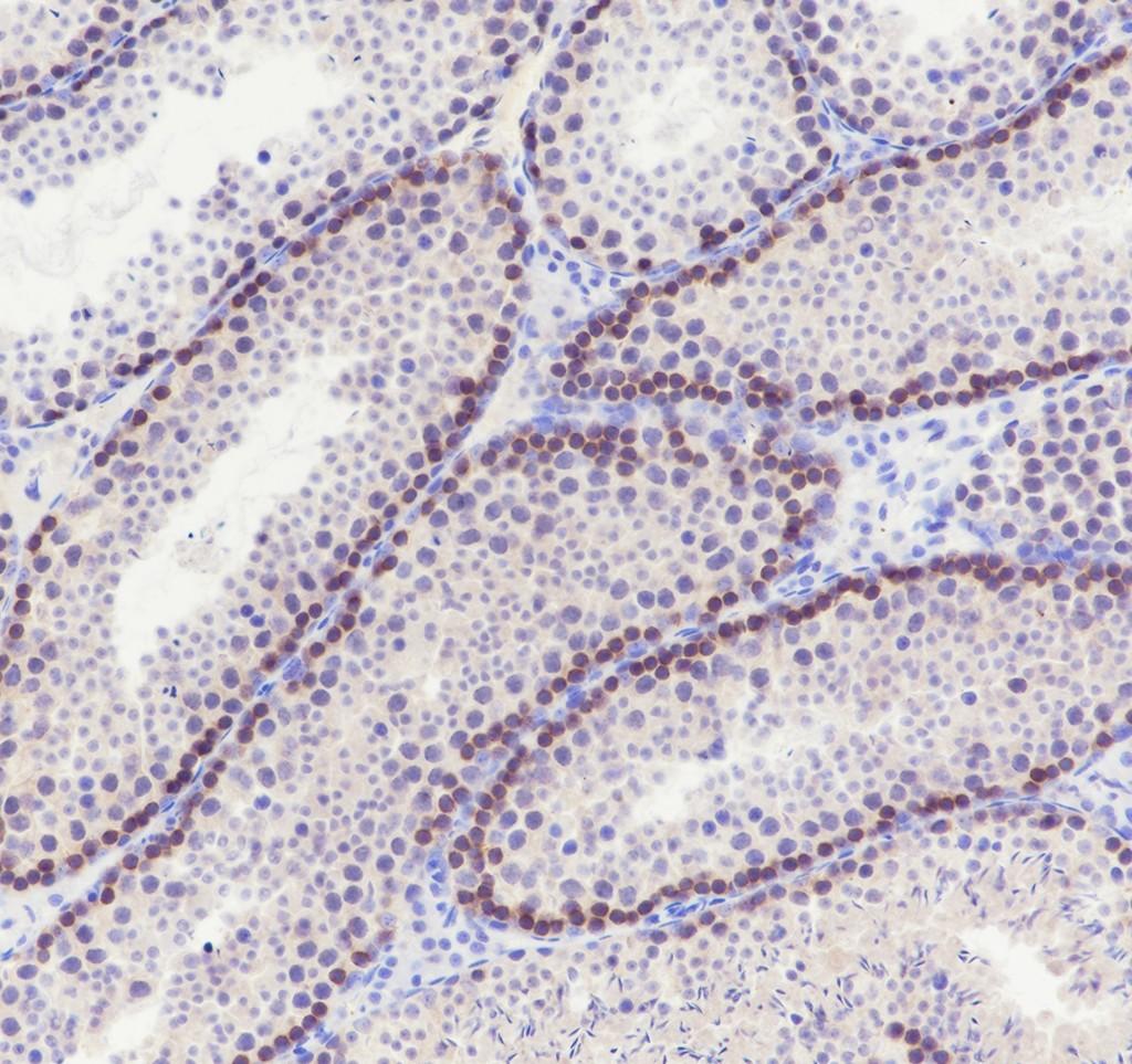 Recombinant CTCFL Monoclonal Antibody - small - 4