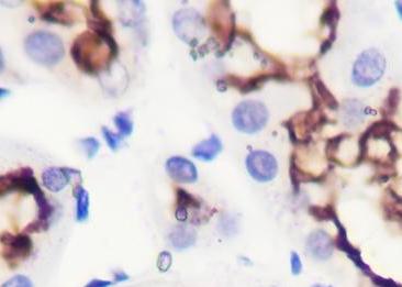 Recombinant ACE2 Monoclonal Antibody-searchlist-2