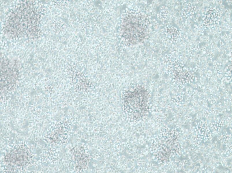 CCRF-SB Cell Complete Medium-searchlist-1