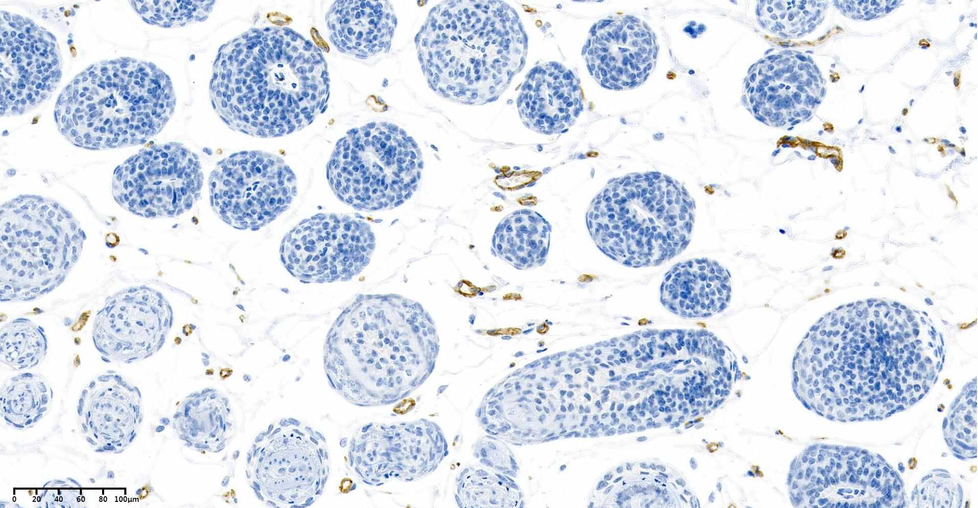 Recombinant CD31 Monoclonal Antibody - small - 6