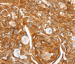 SFTPA1 Polyclonal Antibody - 2