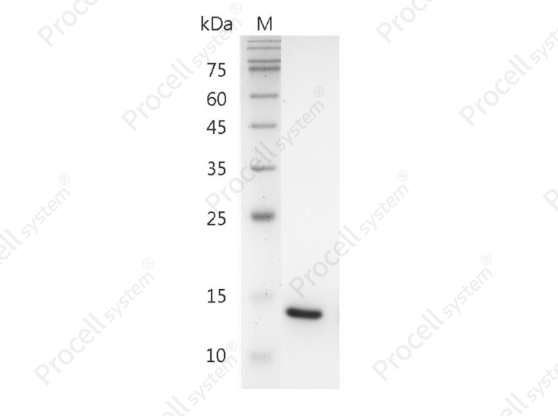 IL-22/IL-TIF, Human, Recombinant