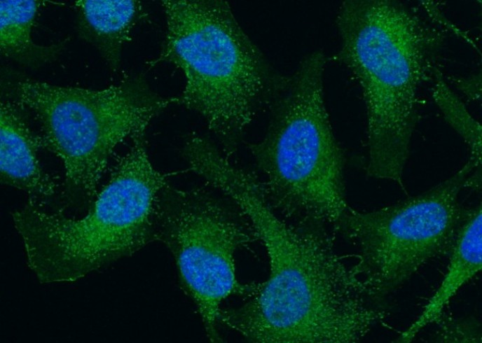 Recombinant SMAC/Diablo Monoclonal Antibody - small - 2