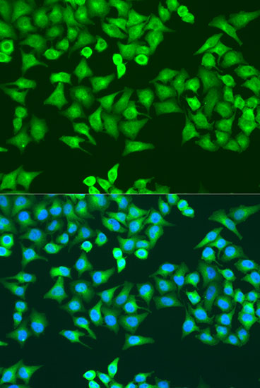 Immunofluorescence analysis of U2OS cells using RRM1 Polyclonal Antibody at dilution of  1:100. Blue: DAPI for nuclear staining.