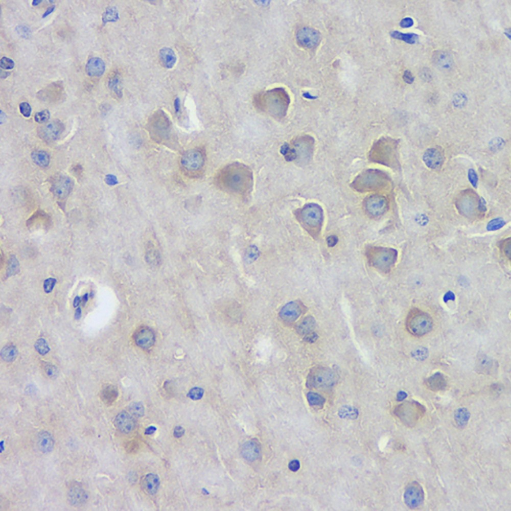 Immunohistochemistry analysis of paraffin-embedded mouse brain  using DLG4 Polyclonal Antibody at dilution of 1:100.