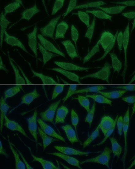 Immunofluorescence analysis of L929 cells using KIF14 Polyclonal Antibody at dilution of  1:100 (40x lens). Blue: DAPI for nuclear staining.