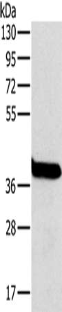 Western Blot analysis of Mouse liver tissue using OTC Polyclonal Antibody at dilution of 1:800