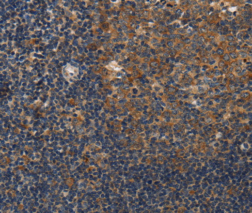 Immunohistochemistry of paraffin-embedded Human tonsil tissue using DSP Polyclonal Antibody at dilution 1:40