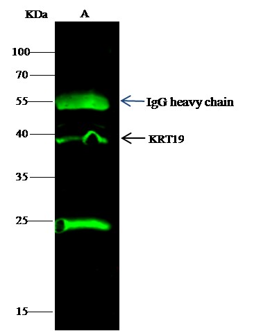 KRT19 Monoclonal Antibody-searchlist-1