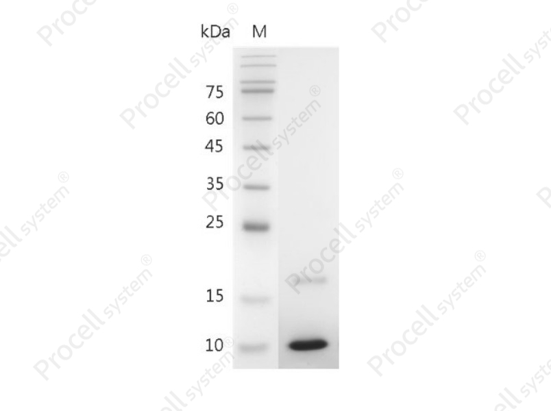 IGF-I/Somatamedin C/IGF-IA, Mouse, Recombinant