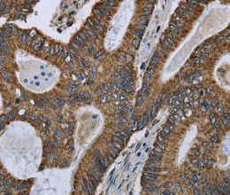 GOT2 Polyclonal Antibody - 2