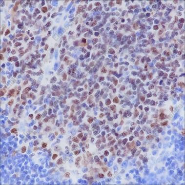 Recombinant BCL6 Monoclonal Antibody - 3