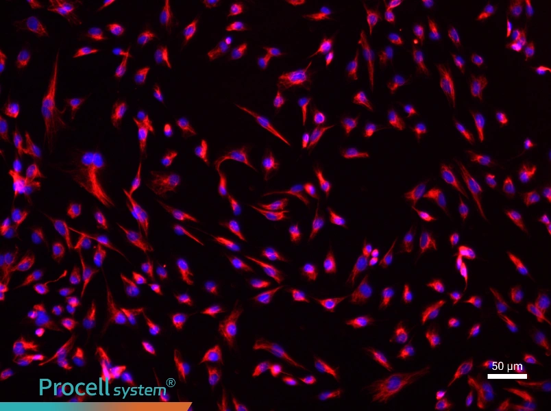 Mouse Renal Fibroblasts - 1