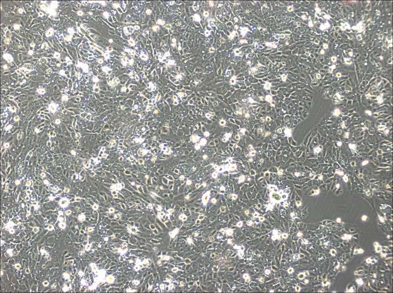 SNU-C5 Cell Complete MediumSNU-C5 Cell Complete Medium - 2