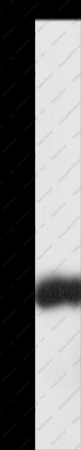 SNAP25 Polyclonal Antibody - 1