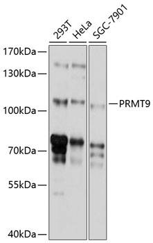 Western blot analysis of extracts of various cell lines using PRMT9 Polyclonal Antibody at 1:1000 dilution.