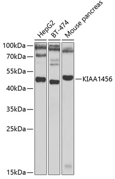 Western blot analysis of extracts of various cell lines using KIAA1456 Polyclonal Antibody at 1:1000 dilution.