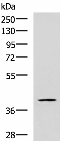 Western blot analysis of TM4 cell lysate  using RAB3IL1 Polyclonal Antibody at dilution of 1:600