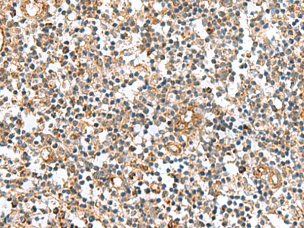 Immunohistochemistry of paraffin-embedded Human tonsil tissue  using MRPS28 Polyclonal Antibody at dilution of 1:60(?200)