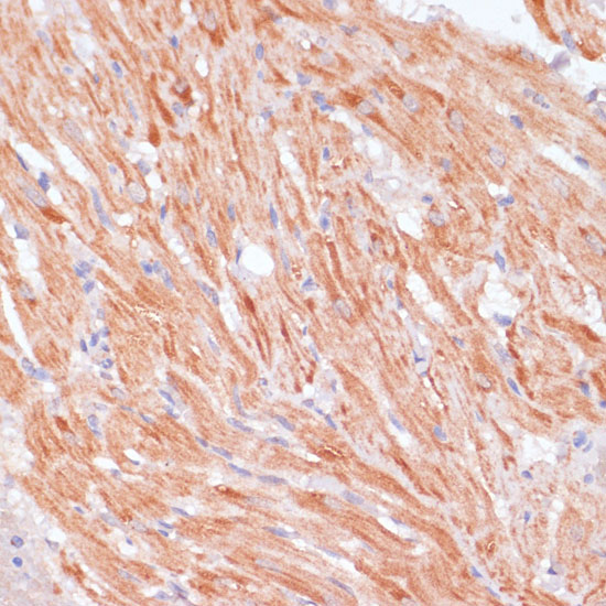 Immunohistochemistry of paraffin-embedded Rat heart using Caspase-9 Polyclonal Antibody at dilution of 1:100 (40x lens).
