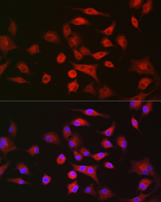 Immunofluorescence analysis of A-549 cells using LLGL1 Polyclonal Antibody at dilution of 1:100. Blue: DAPI for nuclear staining.