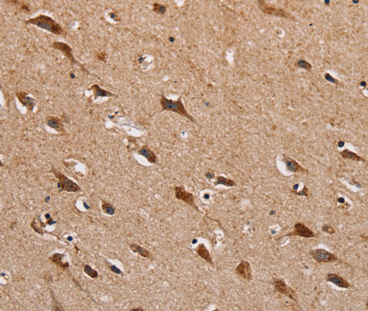 Immunohistochemistry of paraffin-embedded Human brain using HTR3C Polyclonal Antibody at dilution of 1:30