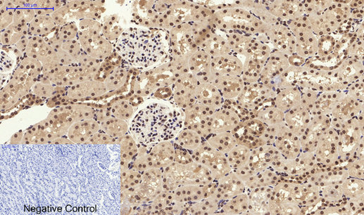 Immunohistochemistry of paraffin-embedded Rat kidney tissue using Stat3 Polyclonal Antibody at dilution of 1:200.