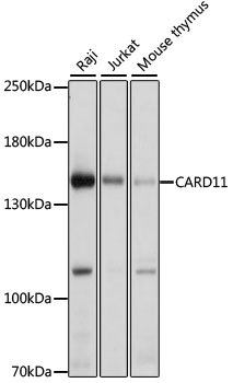 Western blot analysis of extracts of various cell lines using CARD11 Polyclonal Antibody at 1:1000 dilution.