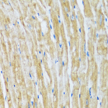 Immunohistochemistry of paraffin-embedded Mouse heart using BAG3 Polyclonal Antibody at dilution of  1:100 (40x lens).