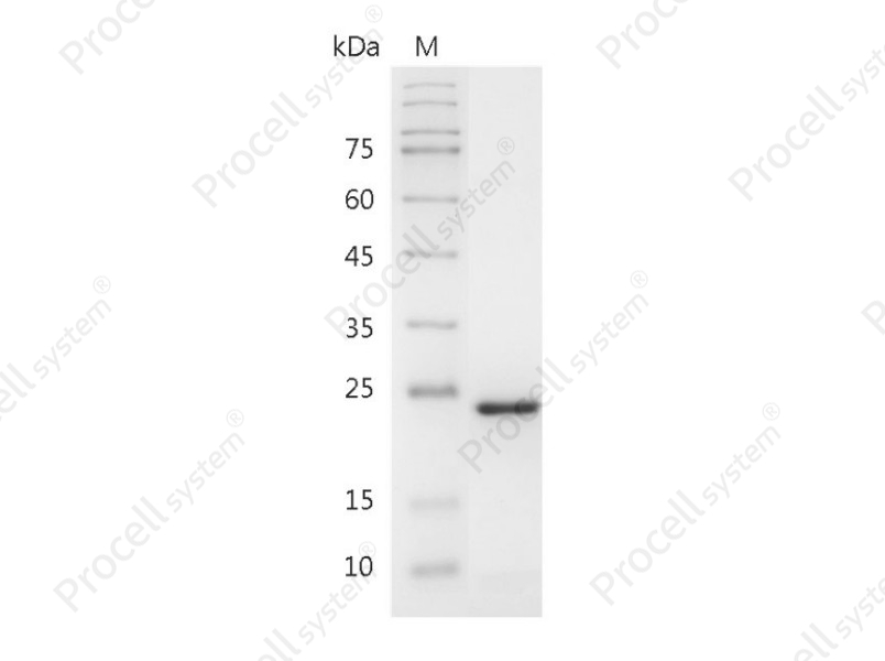 FGF-21/FGFL, Human, Recombinant