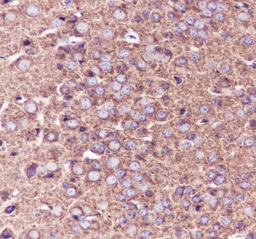 Recombinant beta II Tubulin Monoclonal Antibody - 3