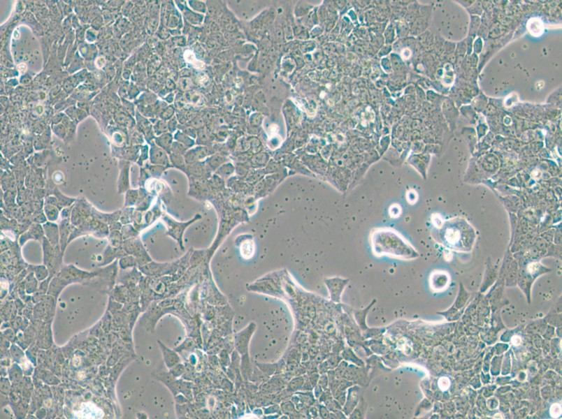 UPCI-SCC-090 Cell Complete Medium - small - 4