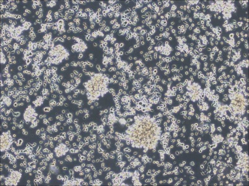 HCC38 BL Cell Complete Medium - 2