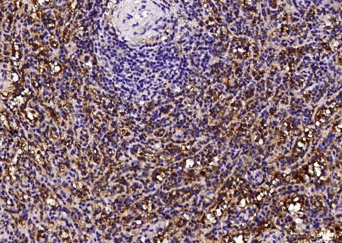 CD16a/FCGR3A Monoclonal Antibody - 1