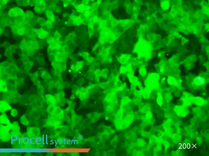 HCT 116-GFP Cell Complete Medium - 6
