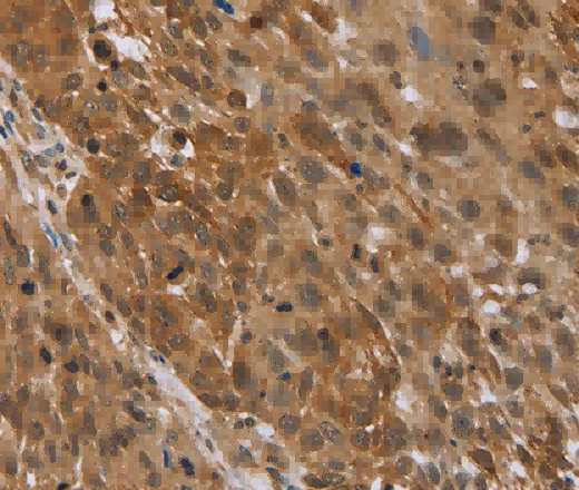 STMN2/3/4 Polyclonal Antibody - 3