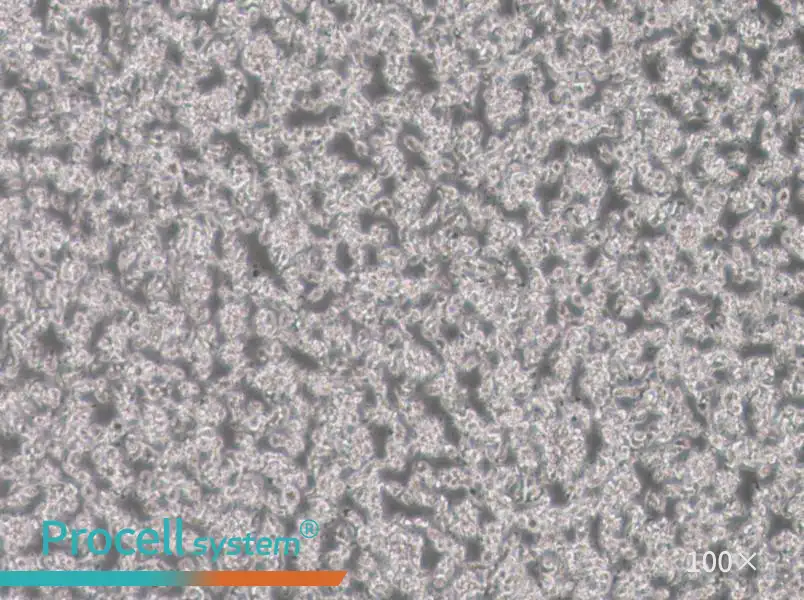 SU-DHL-1 Cell Complete Medium - 1